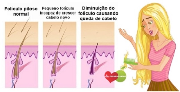 Dica De SaÚde As 10 Dicas De Como Evitar A Queda De Cabelo Astir